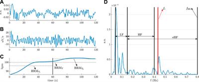 Autonomic response to walk tests is useful for assessing outcome measures in people with multiple sclerosis